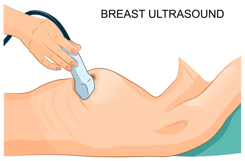 breast