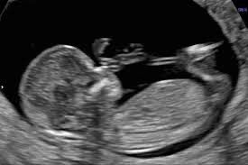 growth scan