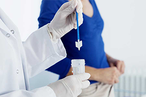 papsmear