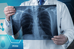 xray
